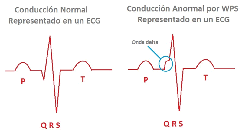 Palpitaciones inesperadas con mareo