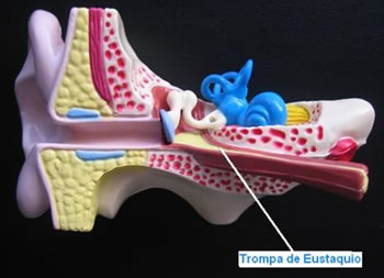 Infección del Oído Medio