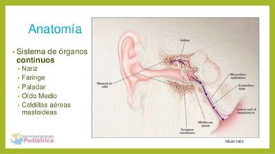 Infección del Oído Medio